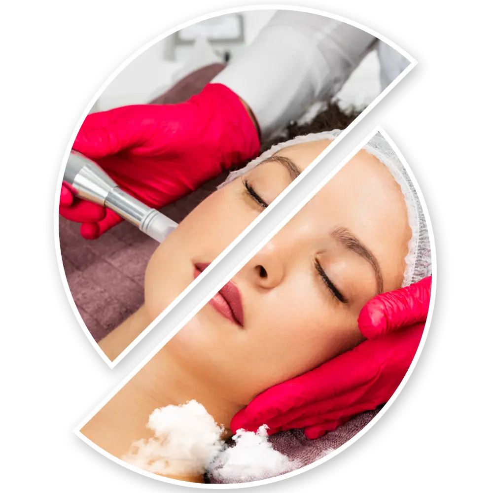 پلاژن تراپی چیست